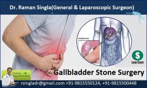 Treatment for gallstones