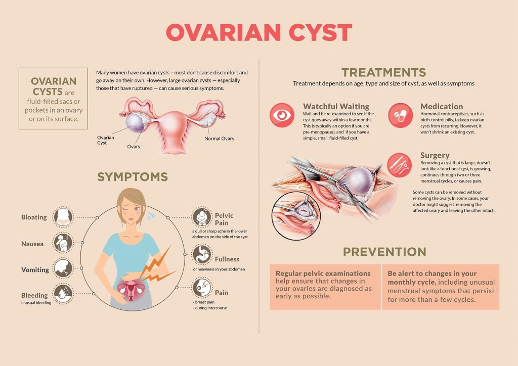 FB live session Ovarian cysts Dr. Rimmy | Singla Mediclinic